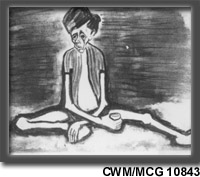 Camp de concentration de Belsen - Malnutrition CWM/MCG 10843